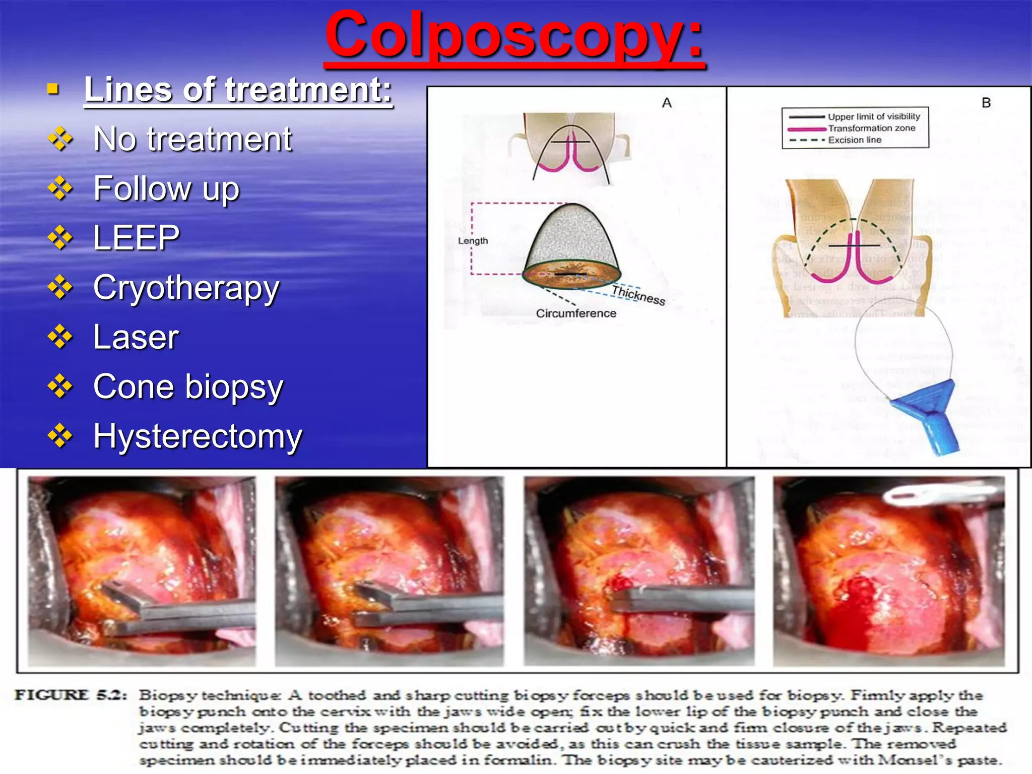 Colposcopy:
 Lines of treatment:
 No treatment
 Follow up
 LEEP
 Cryotherapy
 Laser
 Cone biopsy
 Hysterectomy
 