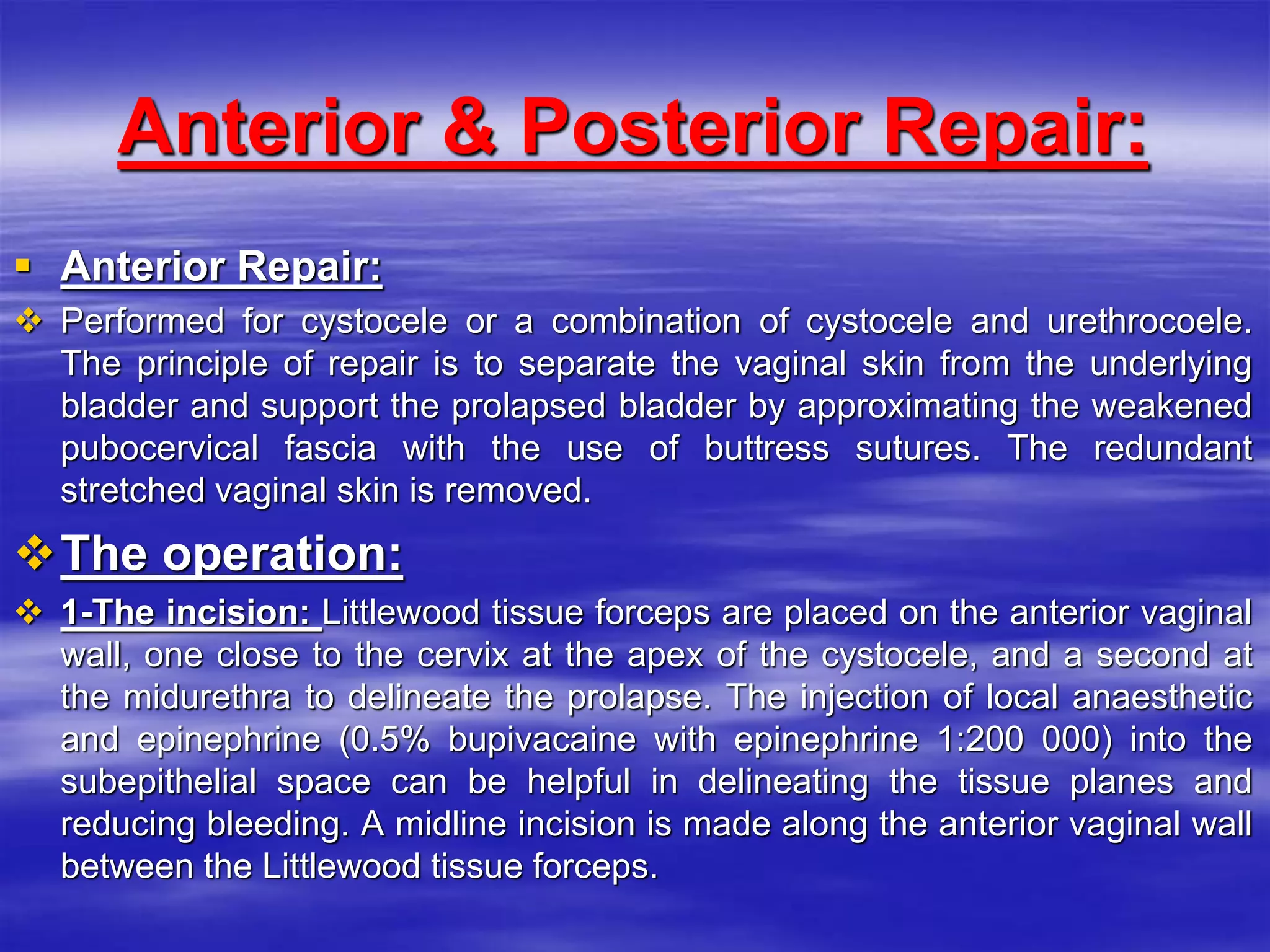 Anterior & Posterior Repair:
 Anterior Repair:
 Performed for cystocele or a combination of cystocele and urethrocoele.
The principle of repair is to separate the vaginal skin from the underlying
bladder and support the prolapsed bladder by approximating the weakened
pubocervical fascia with the use of buttress sutures. The redundant
stretched vaginal skin is removed.
The operation:
 1-The incision: Littlewood tissue forceps are placed on the anterior vaginal
wall, one close to the cervix at the apex of the cystocele, and a second at
the midurethra to delineate the prolapse. The injection of local anaesthetic
and epinephrine (0.5% bupivacaine with epinephrine 1:200 000) into the
subepithelial space can be helpful in delineating the tissue planes and
reducing bleeding. A midline incision is made along the anterior vaginal wall
between the Littlewood tissue forceps.
 