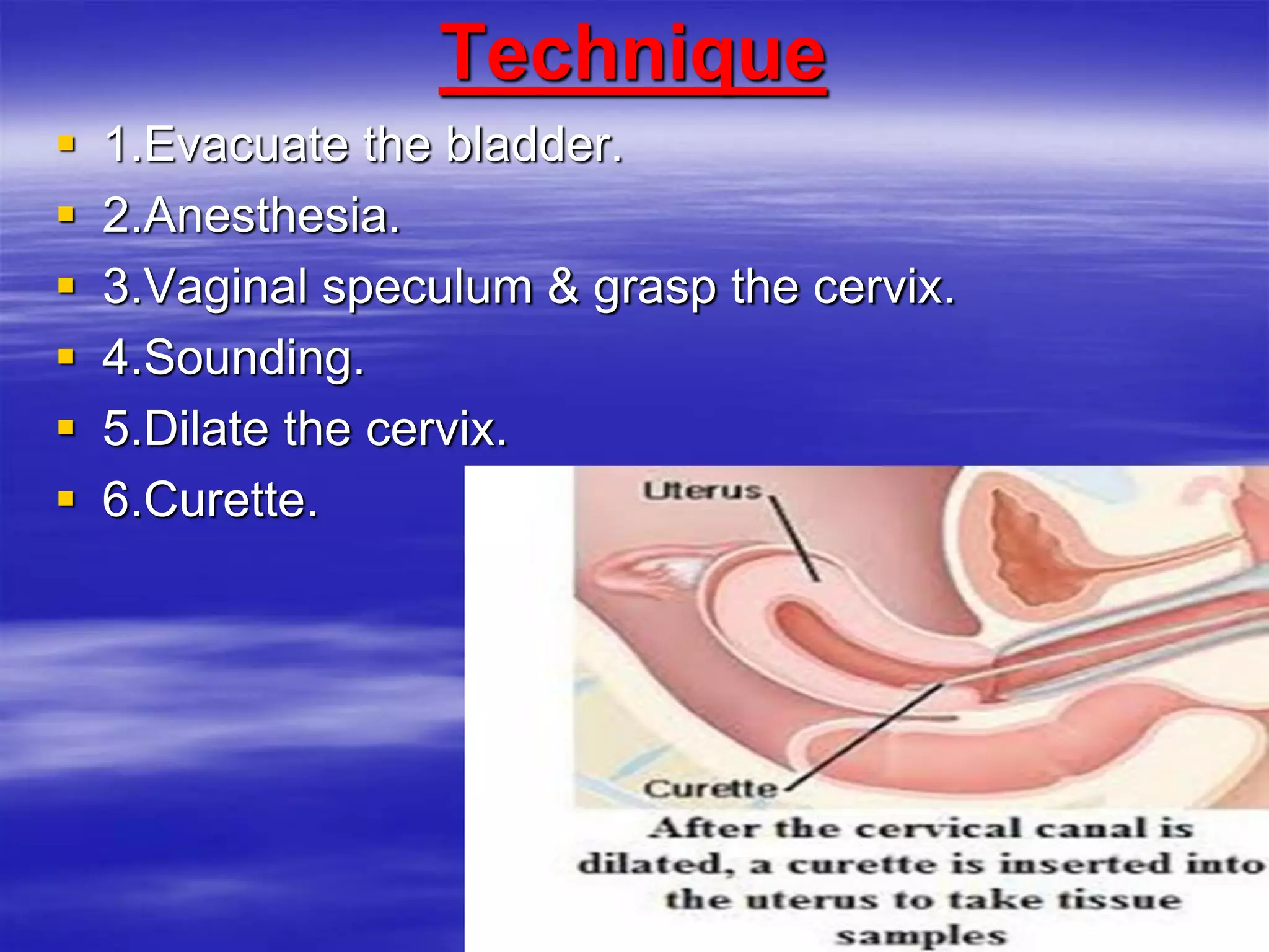 Technique
 1.Evacuate the bladder.
 2.Anesthesia.
 3.Vaginal speculum & grasp the cervix.
 4.Sounding.
 5.Dilate the cervix.
 6.Curette.
 