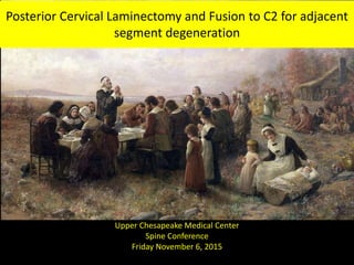 Posterior Cervical Laminectomy and Fusion to C2 for adjacent
segment degeneration
Upper Chesapeake Medical Center
Spine Conference
Friday November 6, 2015
 
