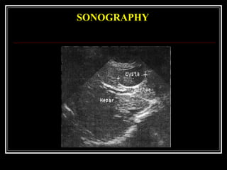 SONOGRAPHY
 