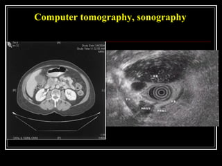 Computer tomography, sonography
 