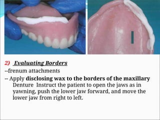 2) Evaluating Borders
--frenum attachments
-- Apply disclosing wax to the borders of the maxillary
Denture Instruct the patient to open the jaws as in
yawning, push the lower jaw forward, and move the
lower jaw from right to left.
 