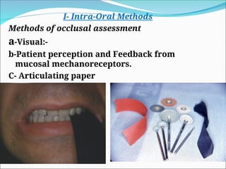 I- Intra-Oral Methods
Methods of occlusal assessment
a-Visual:-
b-Patient perception and Feedback from
mucosal mechanoreceptors.
C- Articulating paper
 