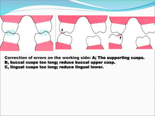 Correction of errors on the working side: A; The supporting cusps.
B, buccal cusps too long; reduce buccal upper cusp.
C, lingual cusps too long; reduce lingual lower.
 