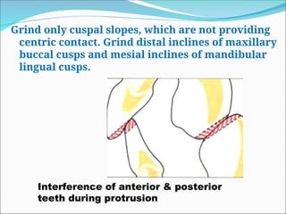 Grind only cuspal slopes, which are not providing
centric contact. Grind distal inclines of maxillary
buccal cusps and mesial inclines of mandibular
lingual cusps.
Interference of anterior & posterior
teeth during protrusion
 