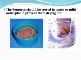 The dentures should be stored in water or mild
antiseptic to prevent them drying out
 