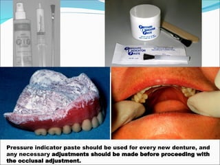 Pressure indicator paste should be used for every new denture, and
any necessary adjustments should be made before proceeding with
the occlusal adjustment.
 