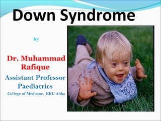 Down Syndrome
by
Dr. Muhammad
Rafique
Assistant Professor
Paediatrics
College of Medicine, KKU Abha
 