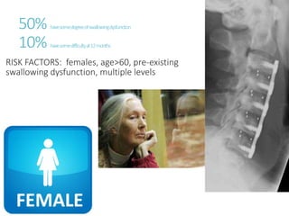 50% havesomedegreeofswallowingdysfunction
10% havesomedifficultyat12months
RISK FACTORS: females, age>60, pre-existing
swallowing dysfunction, multiple levels
 
