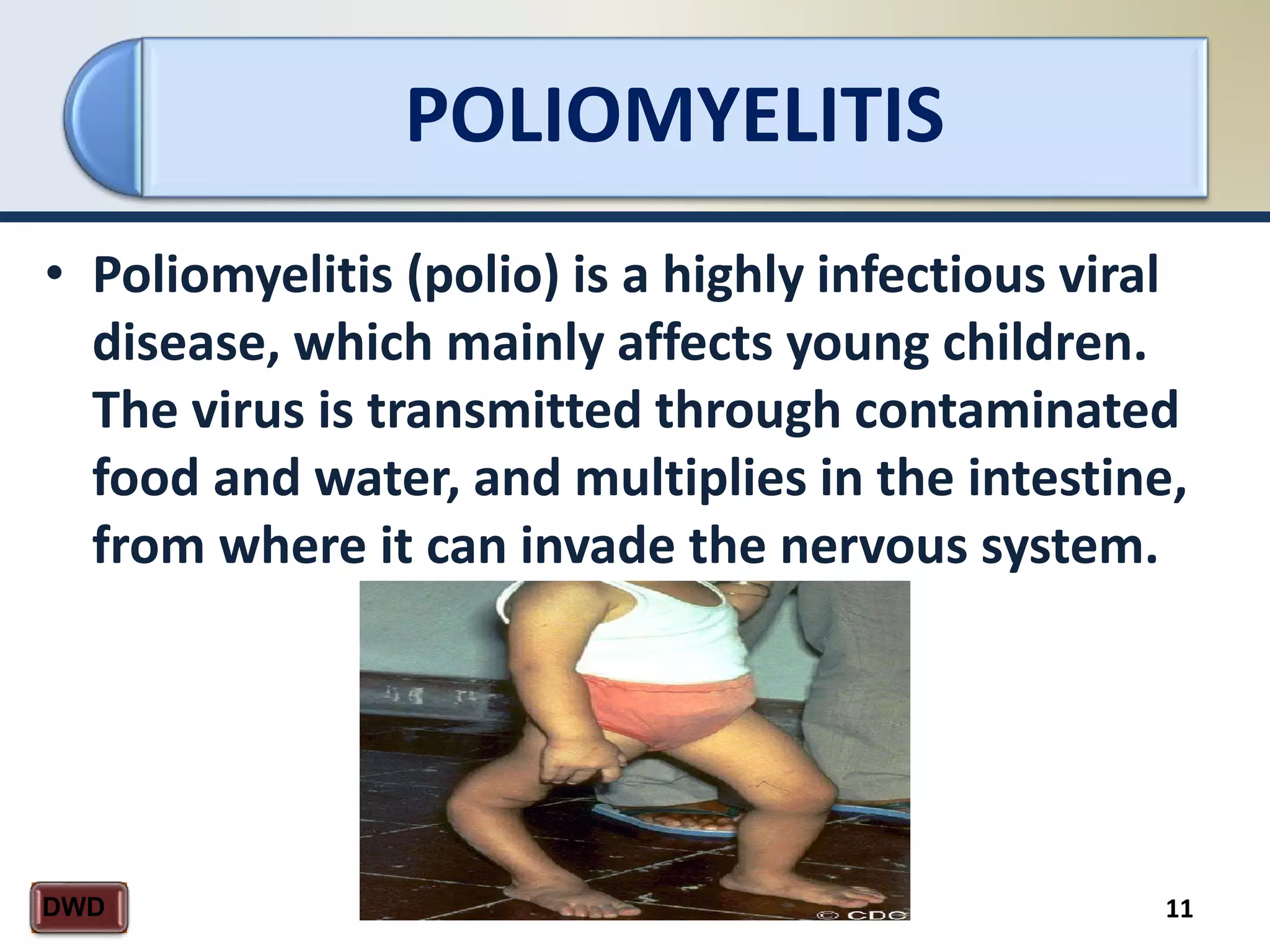 POLIOMYELITIS
11DWD
• Poliomyelitis (polio) is a highly infectious viral
disease, which mainly affects young children.
The virus is transmitted through contaminated
food and water, and multiplies in the intestine,
from where it can invade the nervous system.