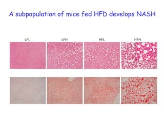 Role of macrophages in lipid metabolism (JBC 2008; Cell Metabolism 2010)hepatic steatosis 		              steatohepatitis (NASH) & fibrosis	cirrhosis