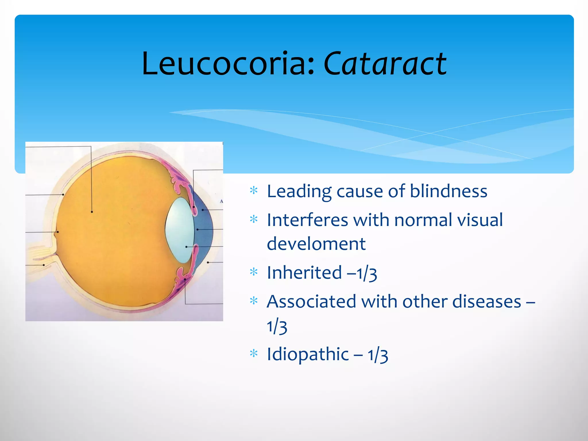 Leucocoria:  Cataract Leading cause of blindness Interferes with normal visual develoment Inherited –1/3 Associated with other diseases – 1/3 Idiopathic – 1/3 