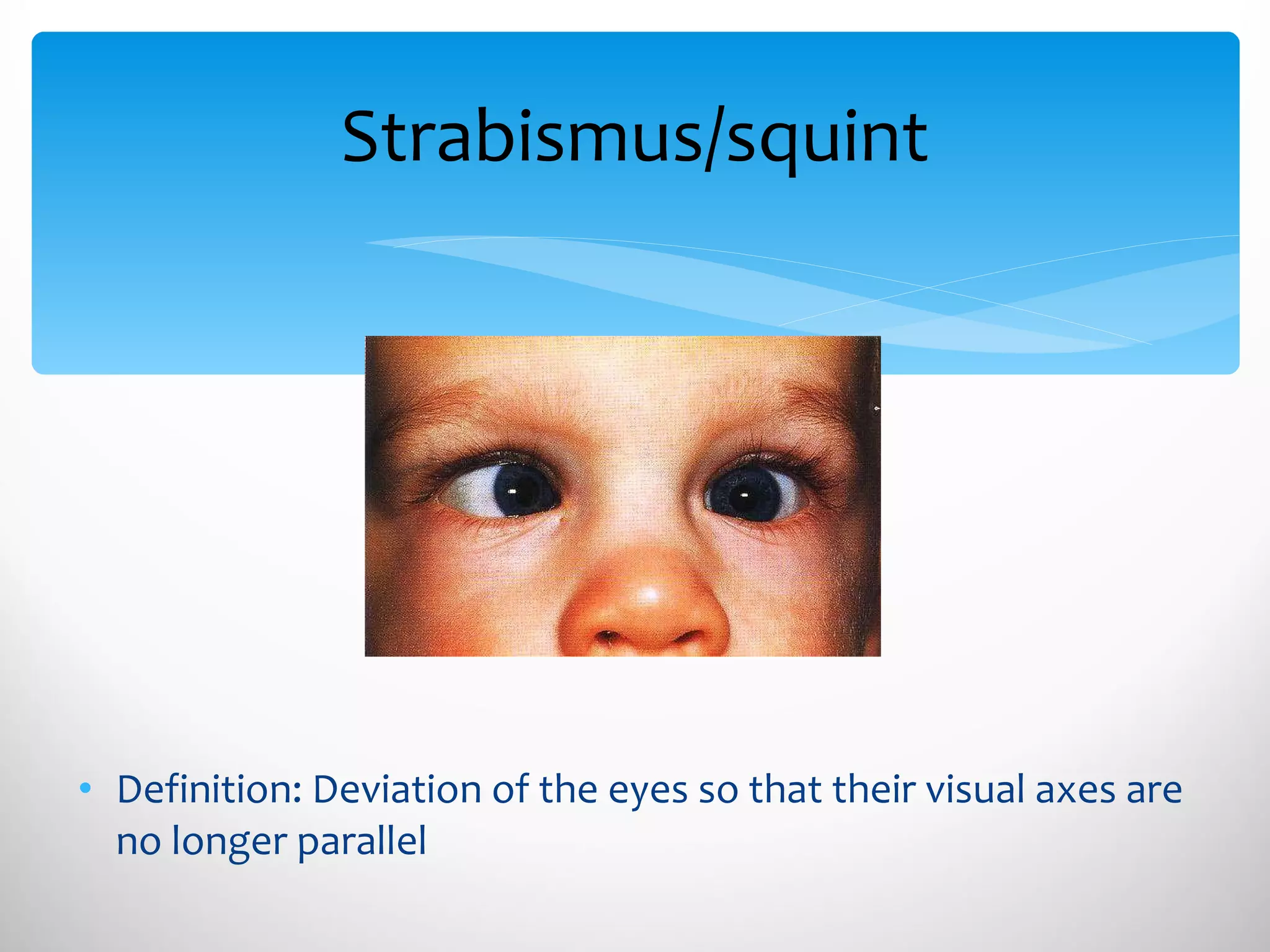 Strabismus/squint Definition: Deviation of the eyes so that their visual axes are no longer parallel 