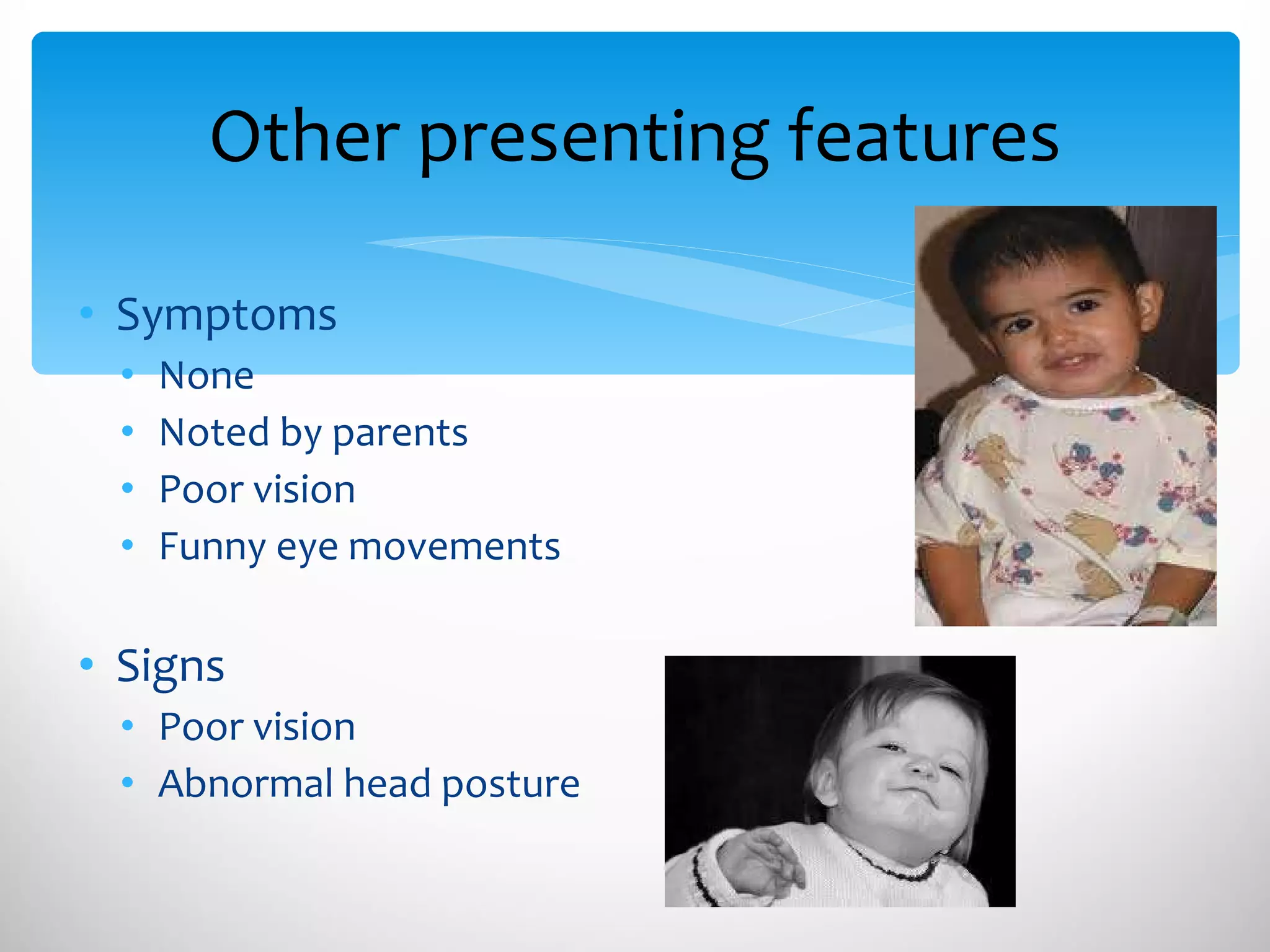 Other presenting features Symptoms None Noted by parents Poor vision Funny eye movements Signs  Poor vision Abnormal head posture 