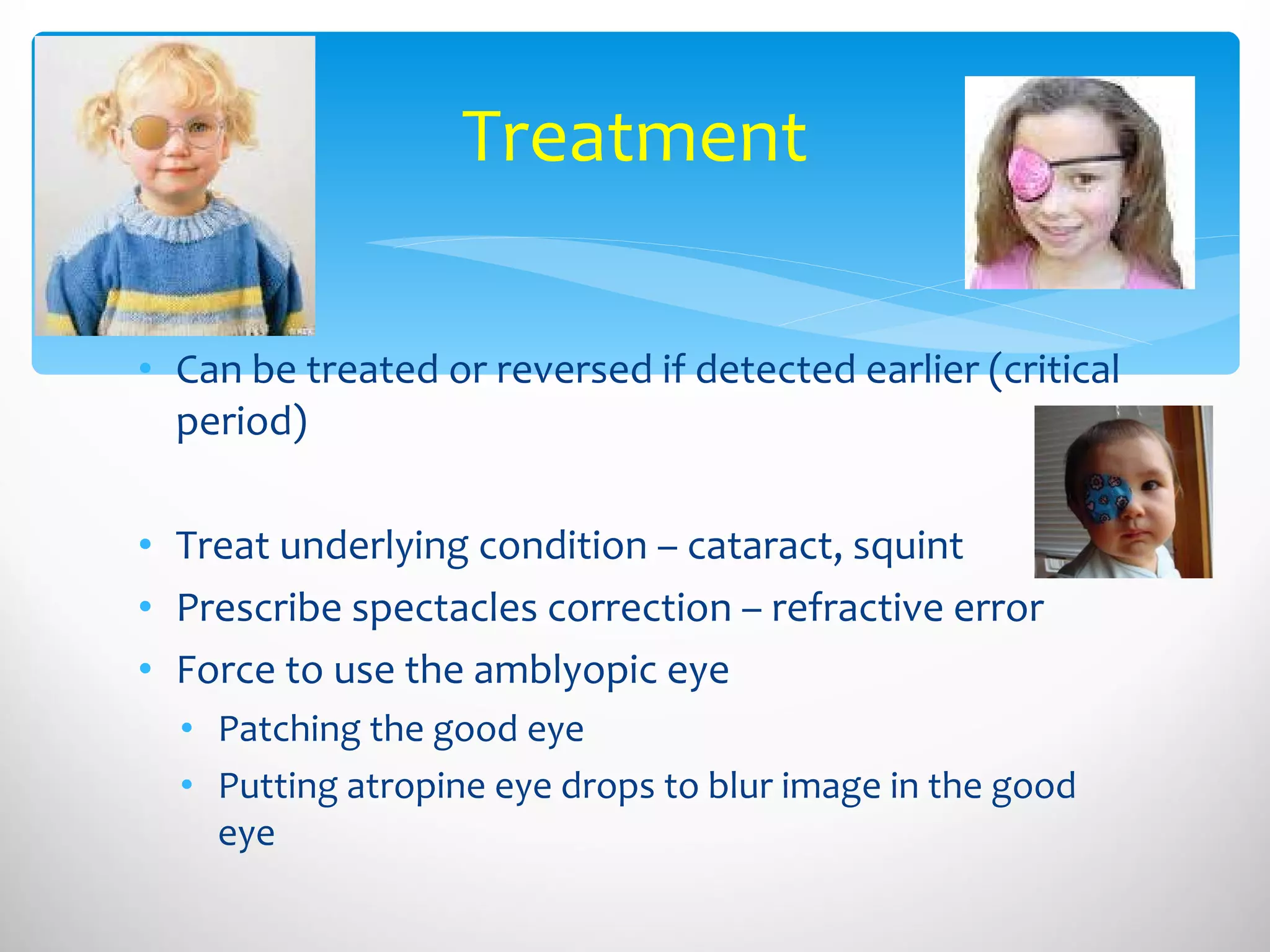 Treatment Can be treated or reversed if detected earlier (critical period) Treat underlying condition – cataract, squint Prescribe spectacles correction – refractive error Force to use the amblyopic eye Patching the good eye Putting atropine eye drops to blur image in the good eye 