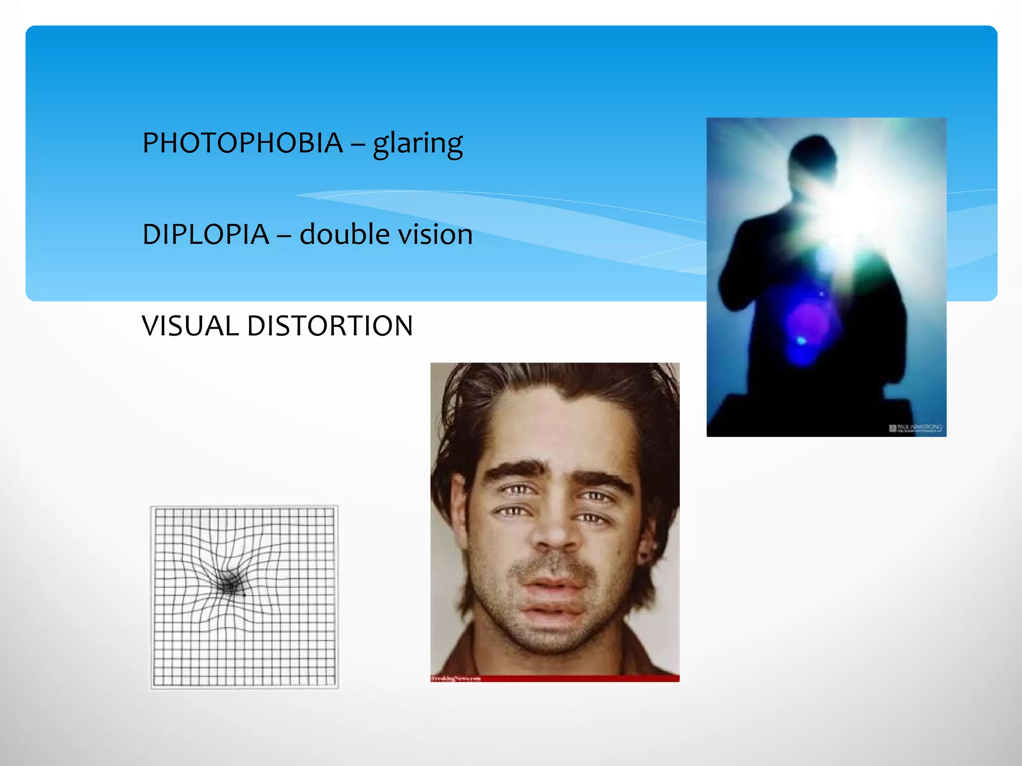 PHOTOPHOBIA – glaring DIPLOPIA – double vision VISUAL DISTORTION 