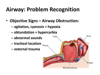 Airway: Problem Recognition
• Objective Signs – Airway Obstruction:
– agitation, cyanosis = hypoxia
– obtundation = hypercarbia
– abnormal sounds
– tracheal location
– external trauma
 