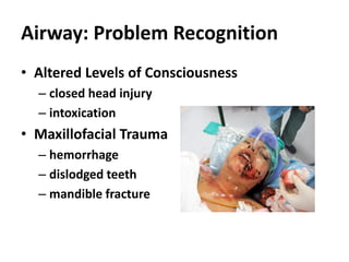 Airway: Problem Recognition
• Altered Levels of Consciousness
– closed head injury
– intoxication
• Maxillofacial Trauma
– hemorrhage
– dislodged teeth
– mandible fracture
 