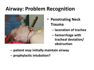 Airway: Problem Recognition
• Penetrating Neck
Trauma
– laceration of trachea
– hemorrhage with
tracheal deviation/
obstruction
– patient may initially maintain airway
– prophylactic intubation?
 