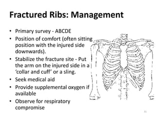 Fractured Ribs: Management
• Primary survey - ABCDE
• Position of comfort (often sitting
position with the injured side
downwards).
• Stabilize the fracture site - Put
the arm on the injured side in a
‘collar and cuff’ or a sling.
• Seek medical aid
• Provide supplemental oxygen if
available
• Observe for respiratory
compromise
31
 