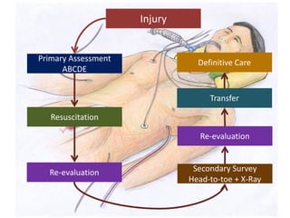 Primary Assessment
ABCDE
Injury
Resuscitation
Re-evaluation Secondary Survey
Head-to-toe + X-Ray
Re-evaluation
Transfer
Definitive Care
 