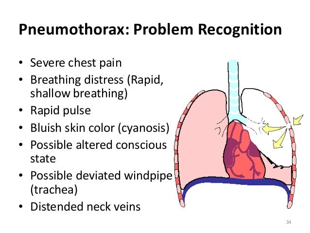 First Aid in Chest Injuries