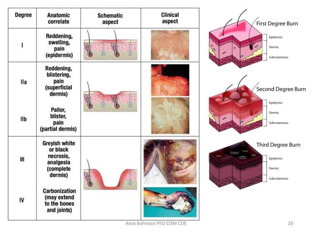 Lecture four burns first Aid