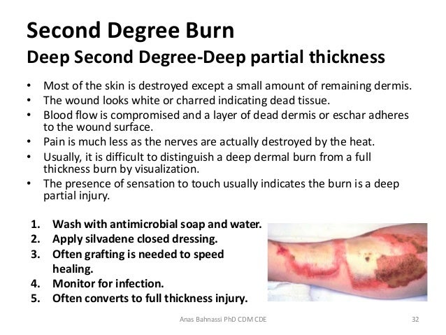 What is the first aid treatment for first degree burns?