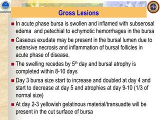 Gross Lesions
◼ In acute phase bursa is swollen and inflamed with subserosal
edema and petechial to echymotic hemorrhages in the bursa
◼ Caseous exudate may be present in the bursal lumen due to
extensive necrosis and inflammation of bursal follicles in
acute phase of disease.
◼ The swelling recedes by 5th day and bursal atrophy is
completed within 8-10 days
◼ Day 3 bursa size start to increase and doubled at day 4 and
start to decrease at day 5 and atrophies at day 9-10 (1/3 of
normal size)
◼ At day 2-3 yellowish gelatinous material/transuadte will be
present in the cut surface of bursa
 