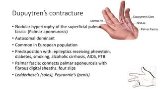 Dupuytren’s contracture
• Nodular hypertrophy of the superficial palmar
fascia (Palmar aponeurosis)
• Autosomal dominant
• Common in European population
• Predisposition with: epileptics receiving phenytoin,
diabetes, smoking, alcoholic cirrhosis, AIDS, PTB
• Palmar fascia: connects palmar aponeurosis with
fibrous digital sheaths, four slips
• Ledderhose’s (soles), Peyronnie’s (penis)
 