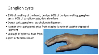 Ganglion cysts
• 95% of swelling of the hand, benign; 60% of benign swelling, ganglion
cysts, 60% of ganglion cysts, dorsal surface
• Dorsal wrist ganglions: scapholunate ligament
• Palmar wrist ganglions: arise from scapho-lunate or scapho-trapezoid
ligament
• Leakage of synovial fluid from
a joint or tendon sheath
 