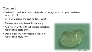 Treatment
• Old traditional treatment: hit it with a book, since the cysts can burst
when struck
• Patient reassurance and no treatment
• Manual compression until bursting
• Aspiration with/without steroid injection:
recurrence (upto 60%)
• Open excision/ Arthroscopic excision:
recurrence (upto 40%)
 