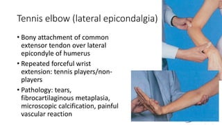 Tennis elbow (lateral epicondalgia)
• Bony attachment of common
extensor tendon over lateral
epicondyle of humerus
• Repeated forceful wrist
extension: tennis players/non-
players
• Pathology: tears,
fibrocartilaginous metaplasia,
microscopic calcification, painful
vascular reaction
 
