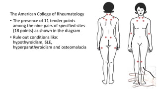 The American College of Rheumatology
• The presence of 11 tender points
among the nine pairs of specified sites
(18 points) as shown in the diagram
• Rule out conditions like:
hypothyroidism, SLE,
hyperparathyroidism and osteomalacia
 