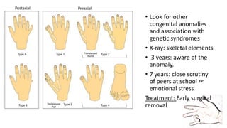 • Look for other
congenital anomalies
and association with
genetic syndromes
• X-ray: skeletal elements
• 3 years: aware of the
anomaly.
• 7 years: close scrutiny
of peers at school ☞
emotional stress
Treatment: Early surgical
removal
 