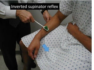 Inverted Reflex Posterior cervical laminoplasty for stenosis | PPTX