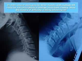 21 male severe! neck pain for three months with multiple ER
visits for narcotics/physical therapy visits/feels clumsy/ three
day history of difficulty walking following fall
 