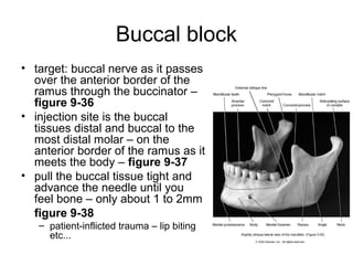 Buccal block
• target: buccal nerve as it passes
  over the anterior border of the
  ramus through the buccinator –
  figure 9-36
• injection site is the buccal
  tissues distal and buccal to the
  most distal molar – on the
  anterior border of the ramus as it
  meets the body – figure 9-37
• pull the buccal tissue tight and
  advance the needle until you
  feel bone – only about 1 to 2mm
  figure 9-38
   – patient-inflicted trauma – lip biting
     etc...
 