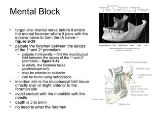 Mental Block
•   target site: mental nerve before it enters
    the mental foramen where it joins with the
    incisive nerve to form the IA nerve –
    figure 9-39
•   palpate the foramen between the apices
    of the 1st and 2nd premolars
     – palpate it intraorally – find the mucobuccal
       fold between the apices of the 1st and 2nd
       premolars – figure 9-42
     – in adults, the foramen faces
       posterosuperiorly
     – may be anterior or posterior
     – can be found using radiographs
•   insertion site is the mucobuccal fold tissue
    directly over or slight anterior to the
    foramen site
•   avoid contact with the mandible with the
    needle
•   depth is 5 to 6mm
•   no need to enter the foramen
 