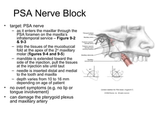 PSA Nerve Block
•   target: PSA nerve
     – as it enters the maxillar through the
       PSA foramen on the maxilla’s
       infratemporal service – Figure 9-2
       & 9-3
     – into the tissues of the mucobuccal
       fold at the apex of the 2nd maxillary
       molar (figures 9-4 and 9-5)
     – mandible is extended toward the
       side of the injection, pull the tissues
       at the injection site until taut
     – needle is inserted distal and medial
       to the tooth and maxilla
     – depth varies from 10 to 16 mm
       depending on age of patient
•   no overt symptoms (e.g. no lip or
    tongue involvement)
•   can damage the pterygoid plexus
    and maxillary artery
 