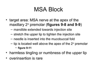 MSA Block
• target area: MSA nerve at the apex of the
  maxillary 2nd premolar (figures 9-8 and 9-9)
  –   mandible extend...