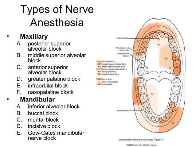 Lecture localanesthesia