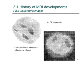 How to read a cervical MRI