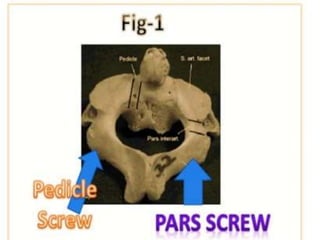 How to read a cervical MRI
