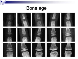 Xbone Ray Lecture Musculoskeletal system in children.pptx