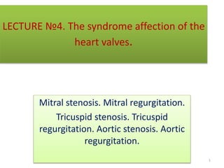 LECTURE №4. The syndrome affection of the
heart valves.
Mitral stenosis. Mitral regurgitation.
Tricuspid stenosis. Tricuspid
regurgitation. Aortic stenosis. Aortic
regurgitation.
1
 