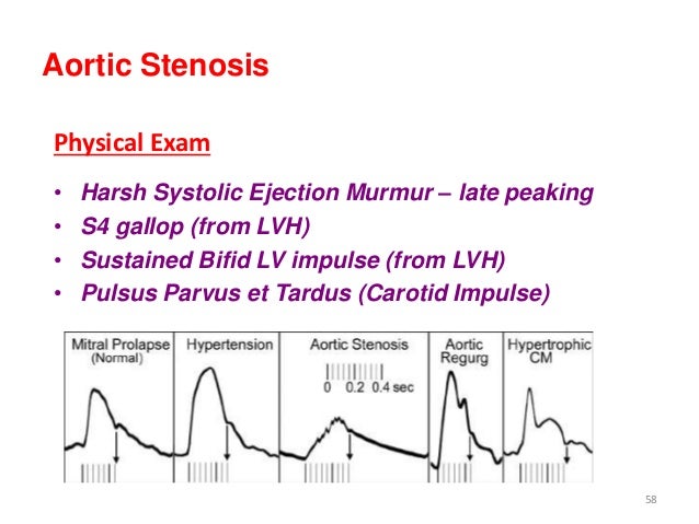 Lecture no.4.cvs,h spptx CVS