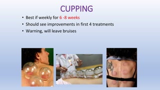 CUPPING
• Best if weekly for 6 -8 weeks
• Should see improvements in first 4 treatments
• Warning, will leave bruises
 