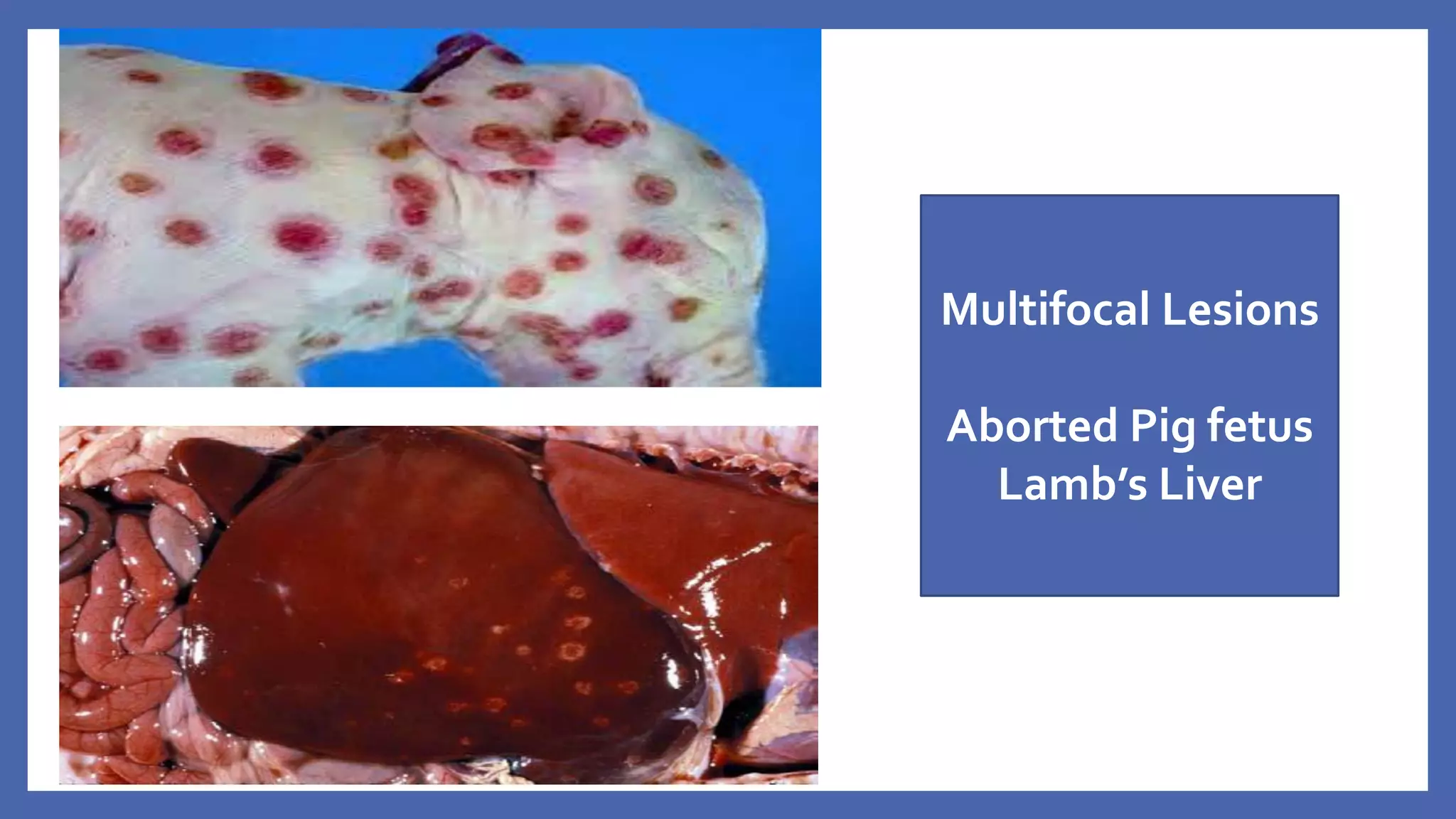 Multifocal Lesions
Aborted Pig fetus
Lamb’s Liver
 